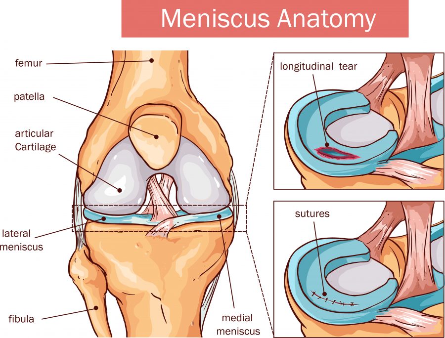 meniscus anatomy, meniscus tears
