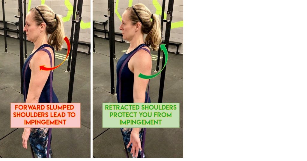 How to Fix Shoulder Pain from Weightlifting - New York Bone