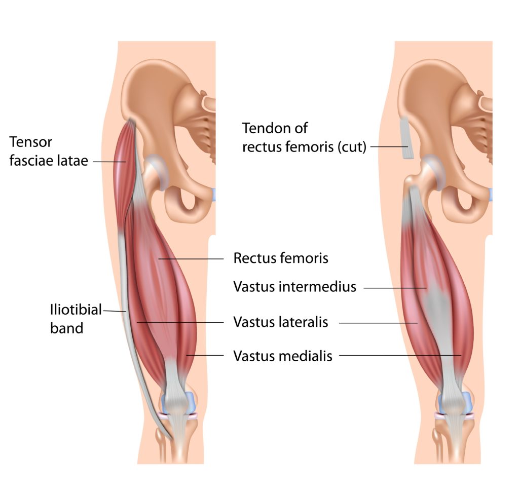 Rowing machine hip flexor new arrivals