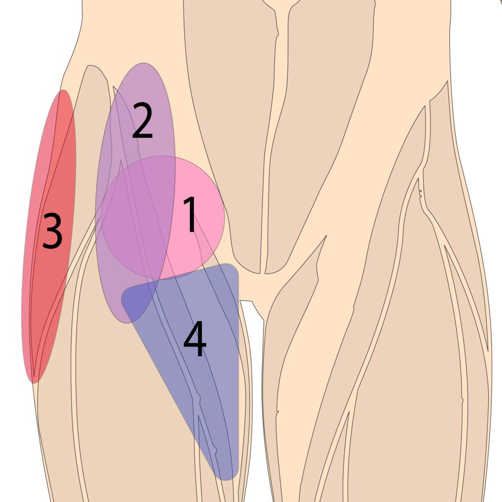 Anterior Hip Pain - Pain at the front of the hip