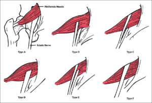 piriformis syndrome anatomy