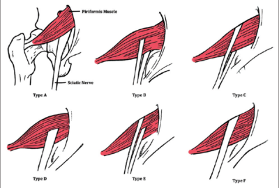 piriformis action above and below 90